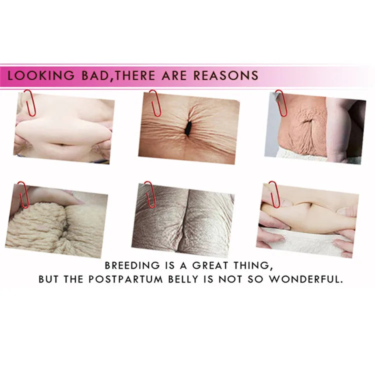 stretch marks removal cream retailers.jpg