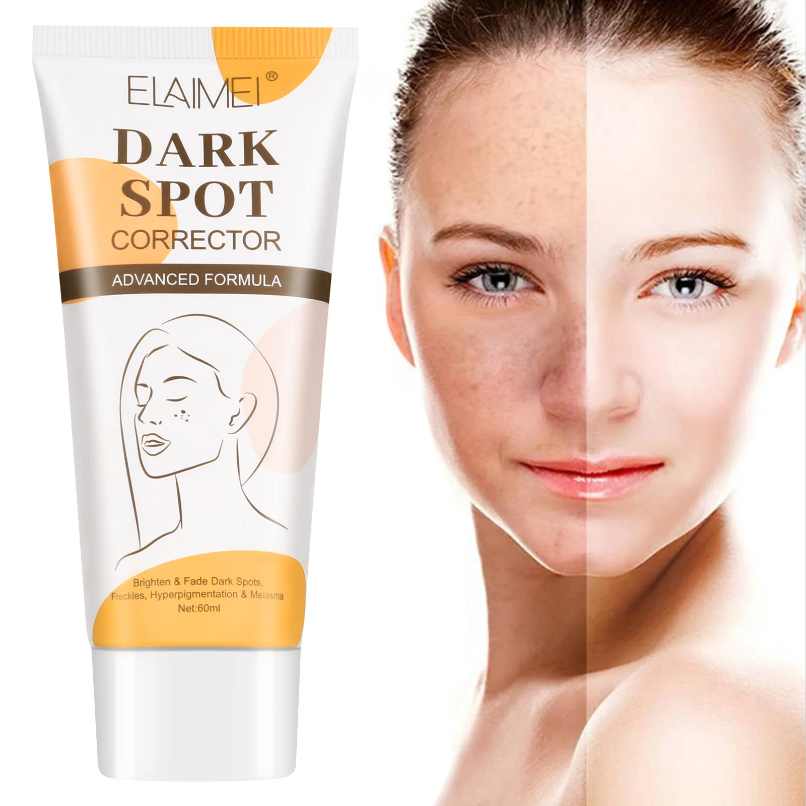 

ELAIMEI Facial Skin Care Niacinamide Beauty Face Remove Dark Spots Corrector Whitening Freckles Removal Cream