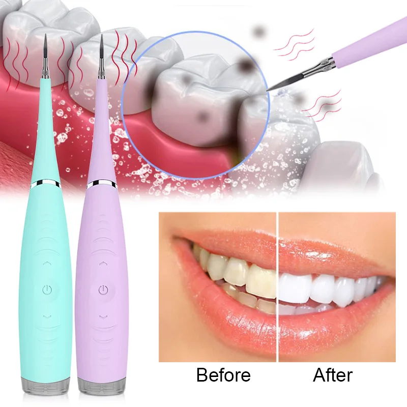 

Portable Electric Ultrasonic Dental Scaler Tooth Calculus Tool Sonic Remover Stains Tartar Plaque Whitening Oral Cleaner Machine, Blue pink