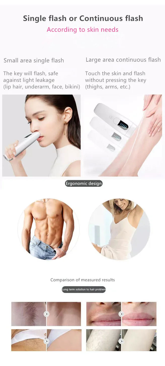 IPL hair removal (9).jpg