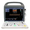 Best-selling hot sale of high quality 2D Portable Color Doppler Ultrasonic Diagnostic System, Convex probe 2 probe connectors