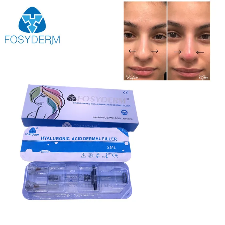 

Hot Sell Nose Dermal Filler Orthovisc Injection Fosyderm 2Ml Deep For Chin Cheeks