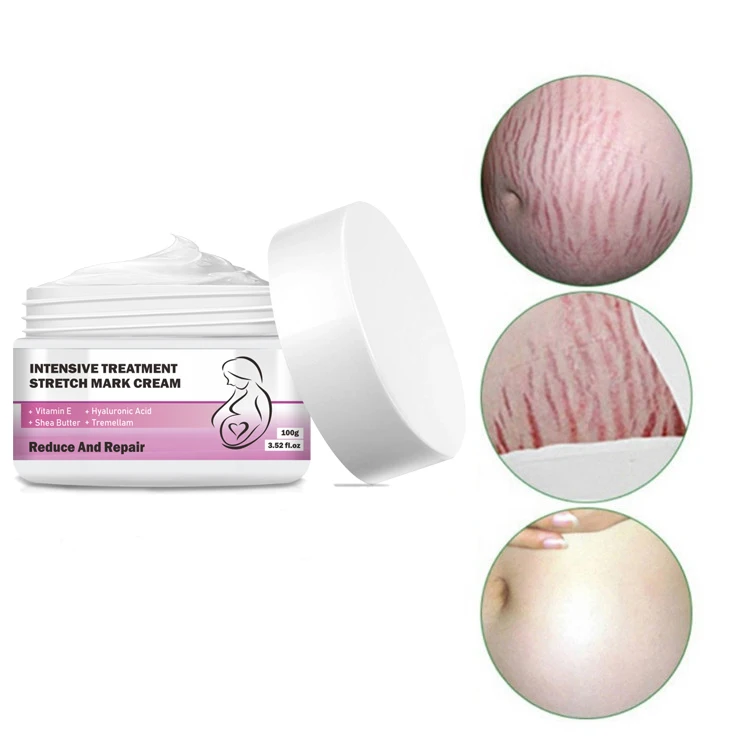 

AH Natural Best Scar Pregnancy Anti Stretch Mark Removal Cream for Private Label