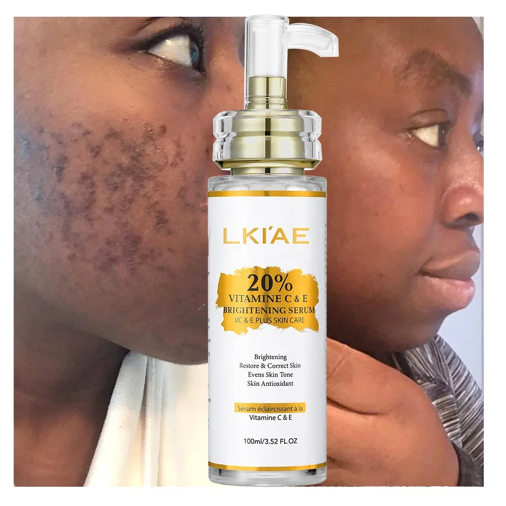 OEM ODM Blemish Dark Spot Correcting Glow Lightening Dark Knuckles Fast Face Vitamin C Whitening Serum for Black Skin