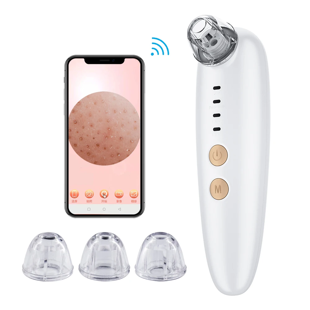 

New arrival built-in HD camera acne pimple cleaner visible mini pore vacuum bubble blackhead remover tool kit, White/green/dark green/customized