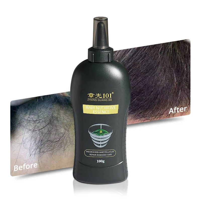 

High Quality Chinese Herbs Extracts Alopecia Treatment Hair Growth Serum
