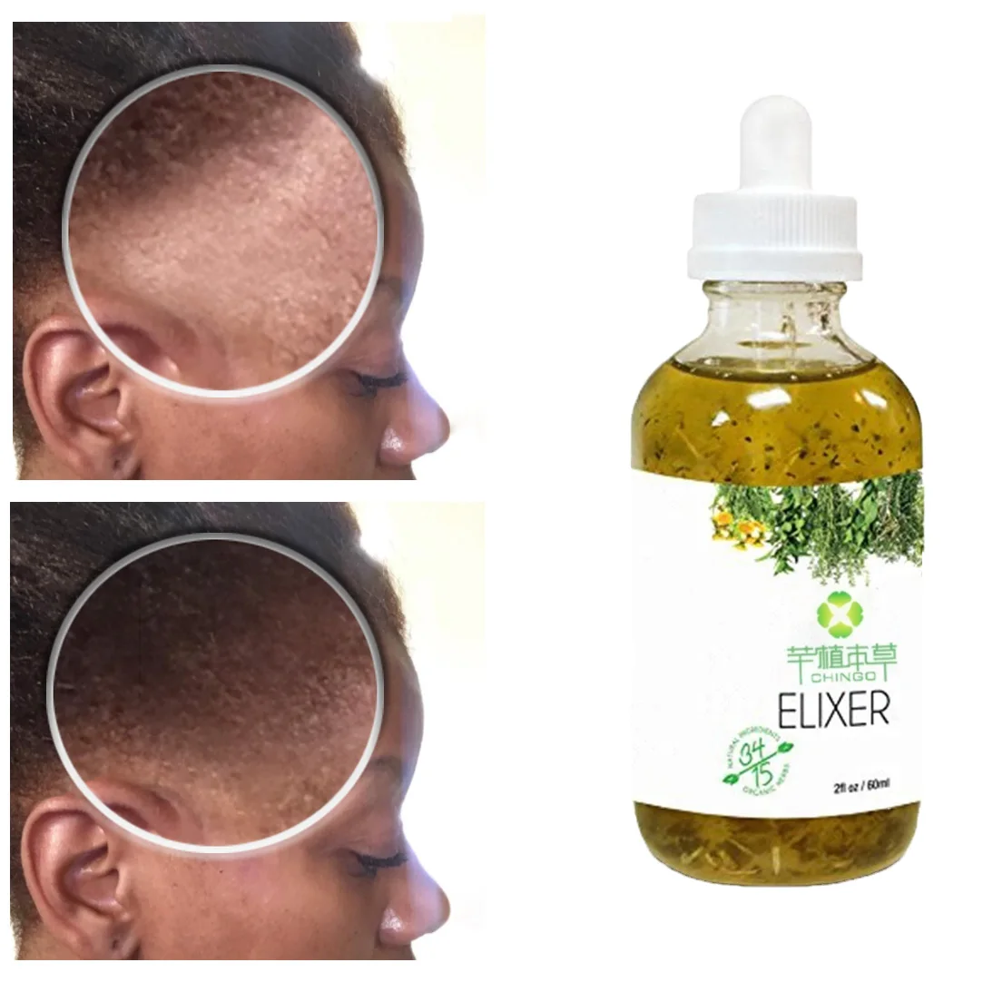 

Hot Sell Private Label 100% Natural Formula Wholesale Nourishing Scalp Elixirs Hair Care Loss Treatment Hair Growth Oil Serum
