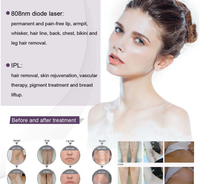 Portable Colorful Tattoo Removal Beauty Laser Machine Polular In Salon
