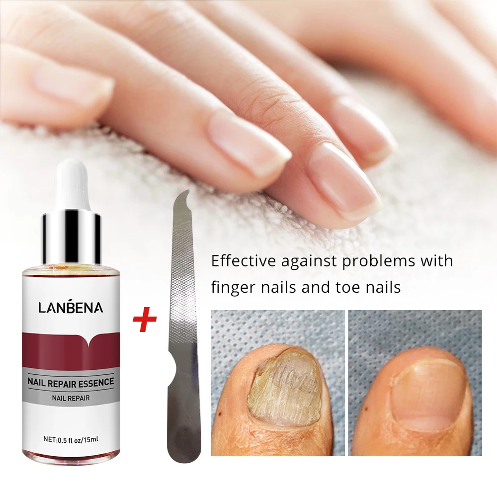 

LANBENA nail repair serum feet care strength liquid for damaged nails