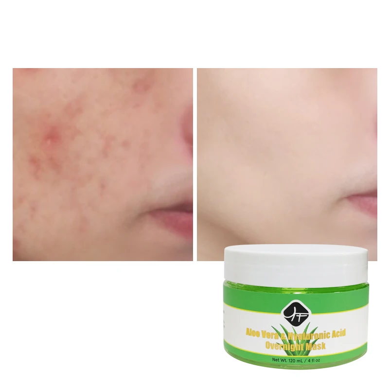 

wholesale organic vegan cosmetic facial mask serum cream skincare beauty whitening facial mask gel
