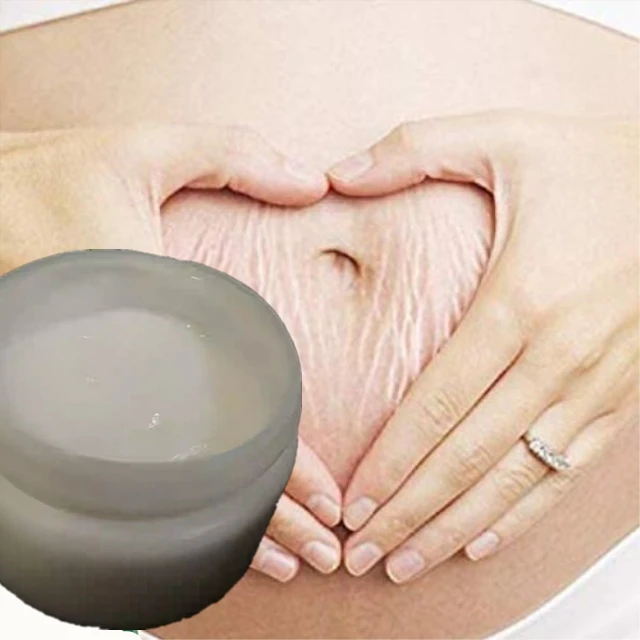 

Bleaching Cream for Strect Mark Removal for All Skin Type