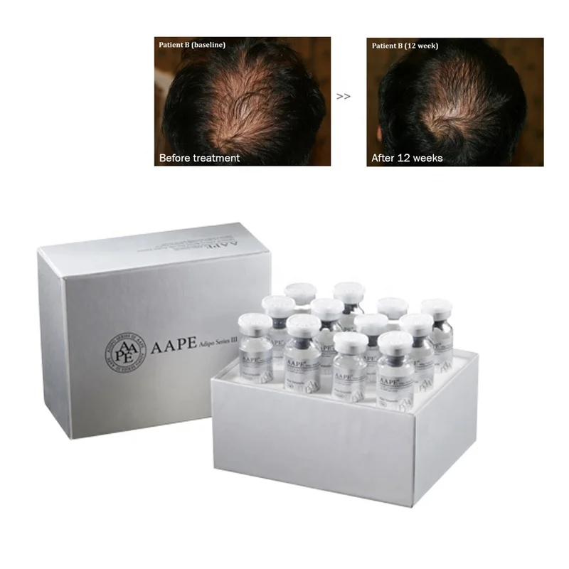 

Anti hair loss mesotherapy stem cell hair growth solution