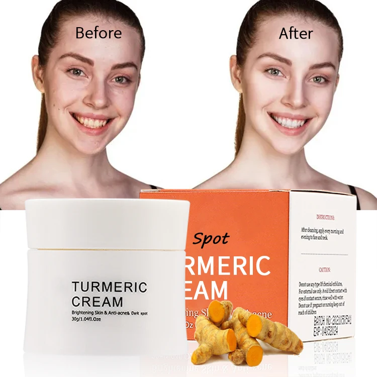 

Natural korea Deep Repair Acne Treatment Face Spot Whitening Turmeric Facial Cream