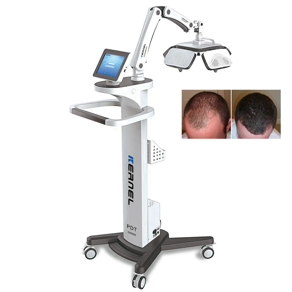 

LLLT 650 nm laser Hair Loss therapy hair growth machine for hair restoration regrowth