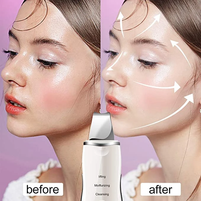 

Electric USB Rechargeable Skin Scrubber Deep Face Cleaning Skin Peel Machine Handheld Ultrasonic skin scrubber face spatula