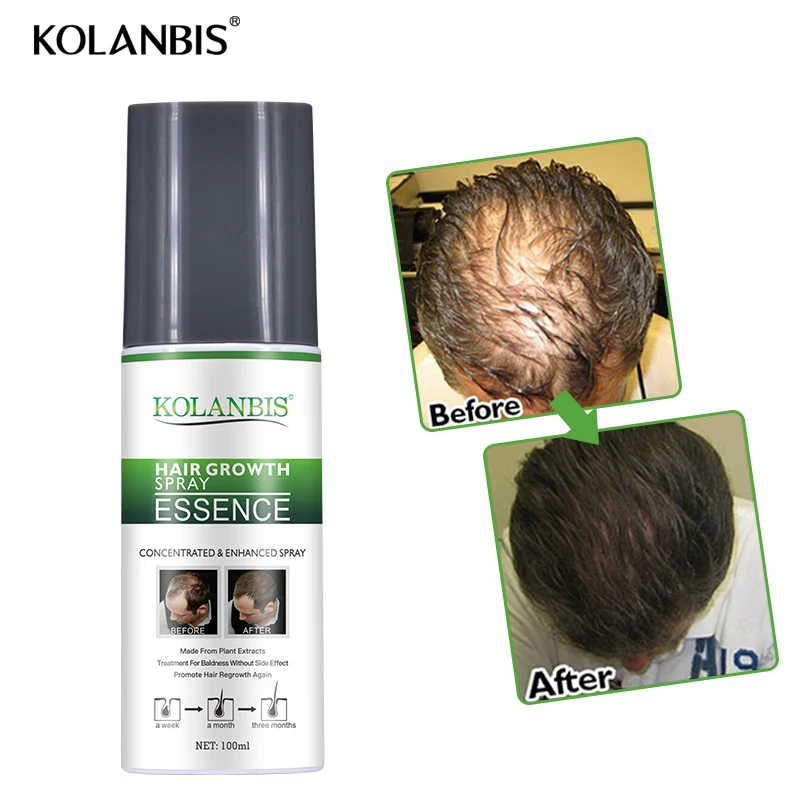 

KOLANBIS organic natural formula effective private label hair growth serum without side effect, Brown