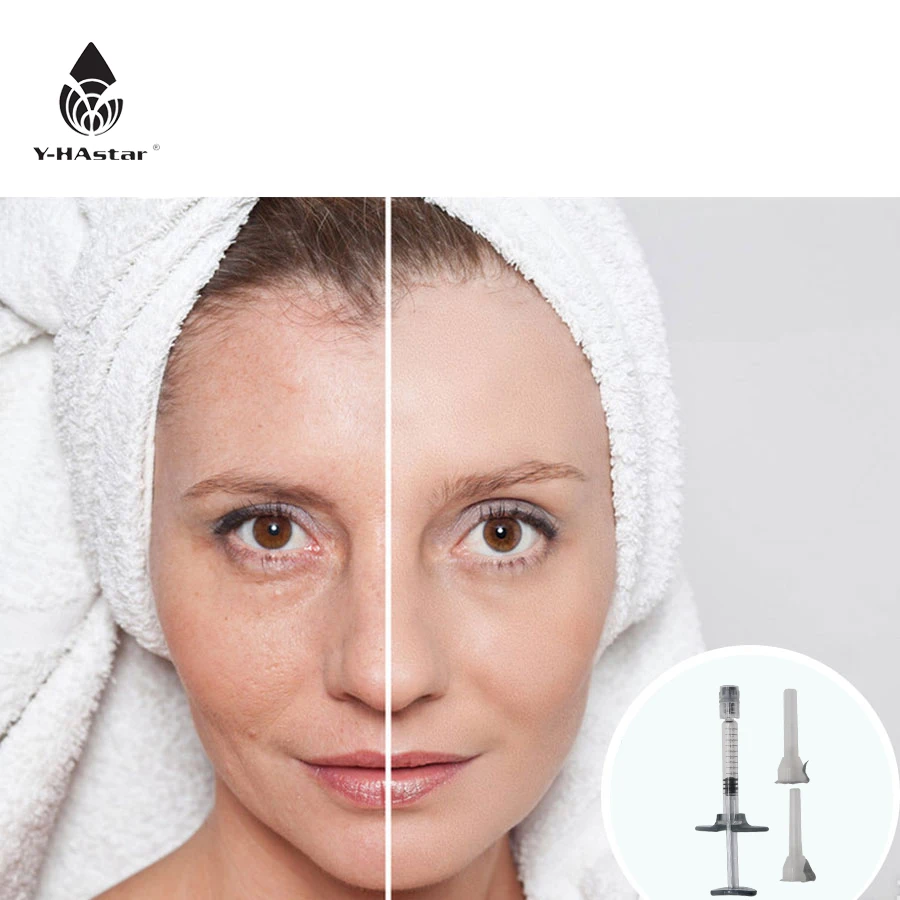 

CE hyaluronic acid facial ha dermal filler 2ml injectable hyaluronic acid dermal fillers