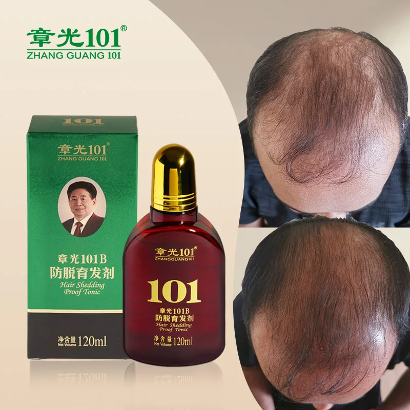 

Wholesale Good Quality Hair Scalp Treatment Anti Hair Loss Serum