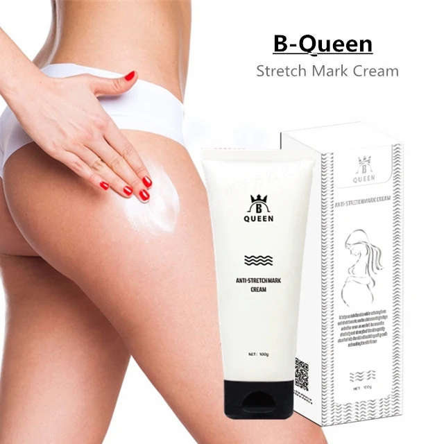 

Top Sale Item Stretch Mark Vanishing Cream for Black Woman, White