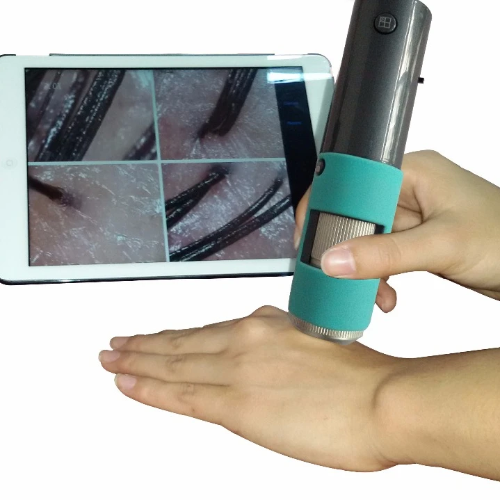 

600X Wireless Portable Surface Analyzer Skin Analysis Scalp Analyzer Hair Analysis Hair Follicle Detection, Black