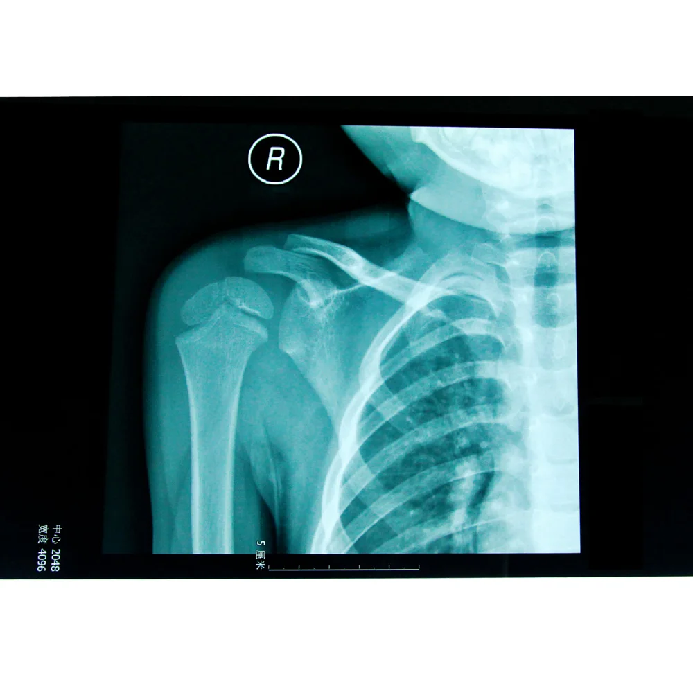 
Factory price Mammography Film/Radiography Film/Breast Medical X ray film 