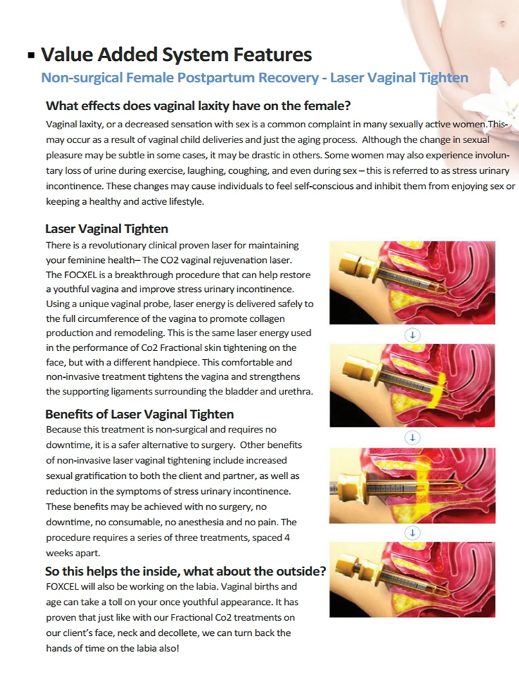 Vaginal Tightening Laser CO2 Fractional Laser For Cosmetology acnescarremoval fractional co2 laser skin resurfacing machine