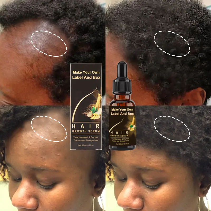 

Custom Logo Anti Loss Split Ends Regrowth Repairing Hair Treatment Scalp Elixirs Private Label Hair Growth Serum Oil