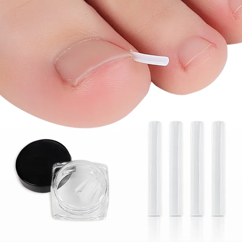 

Ingrown Toenail Tool Ingrown Toenail Corrector pad 10 pcs Straightener Clip Pedicure Tools Toe Nail Care Protects Toe, White