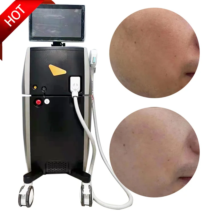 

New Arrival Black Gold DPL Ultra Photon Skin Rejuvenation Beauty Machine Spot Removal Skin Lifting Machine