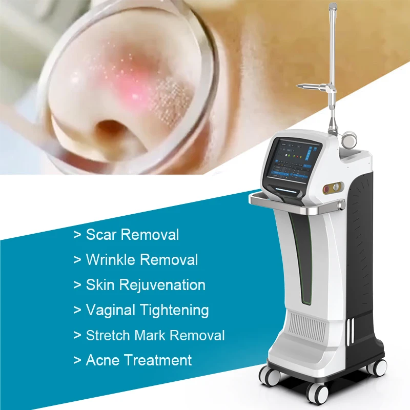 

2023 Taibo scar removal skin resurfacing rejuvenation vaginal laser tightening equipment tube fractional co2 laser machine