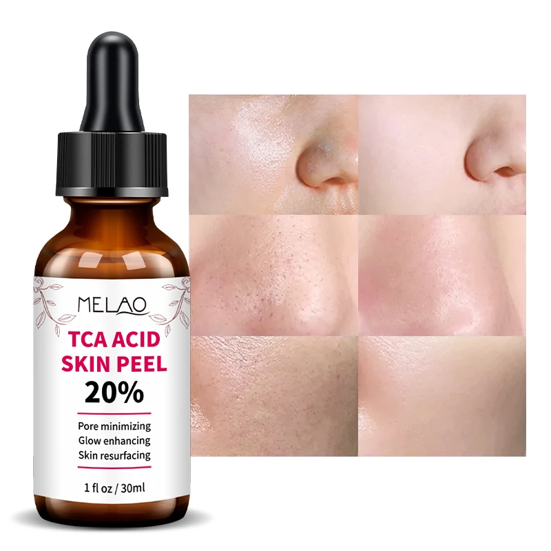 

OEM/ODM Facial Care Melao Natural Anti Acne Moisturizing Smooth Skin TCA Acid Skin Peel Serum