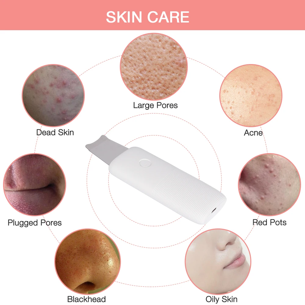 

vibration massager Pore cleaning equipment ultrasonic skin scrubber, White