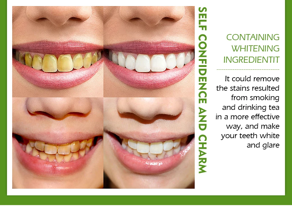 Vibrant Glamour Teeth Whitening Pen Cleaning Serum Remove Stains Dental Tools Oral Hygiene Tooth Gel Whitening Care Buy Teeth Whitening Machine Teeth Whitening Pen Teeth Whitening Strips Product On Alibaba Com