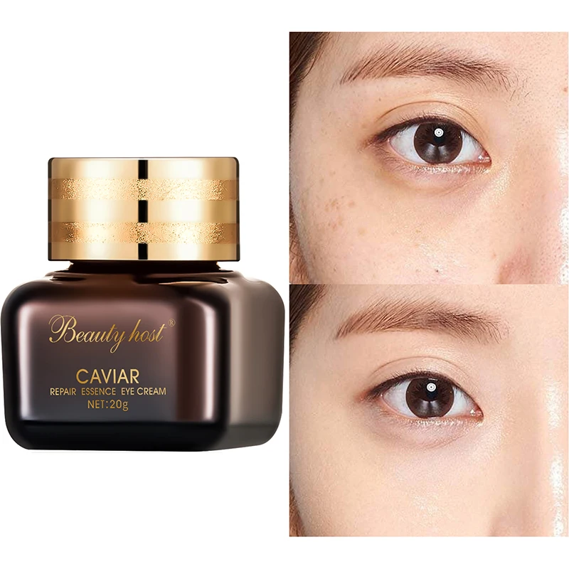 

Remove Dark Circle Eyes Cream Caviar Repair Anti Aging Anti Wrinkle Eye Cream