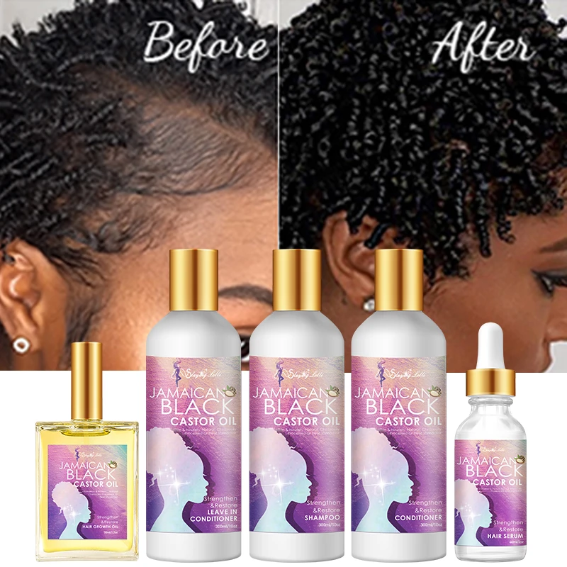 

Private Label Anti-breakage and Anti-frizz Hair Oil Natural Organic Grow Hair Growth Serum Oil for Black Women 4C curl hair
