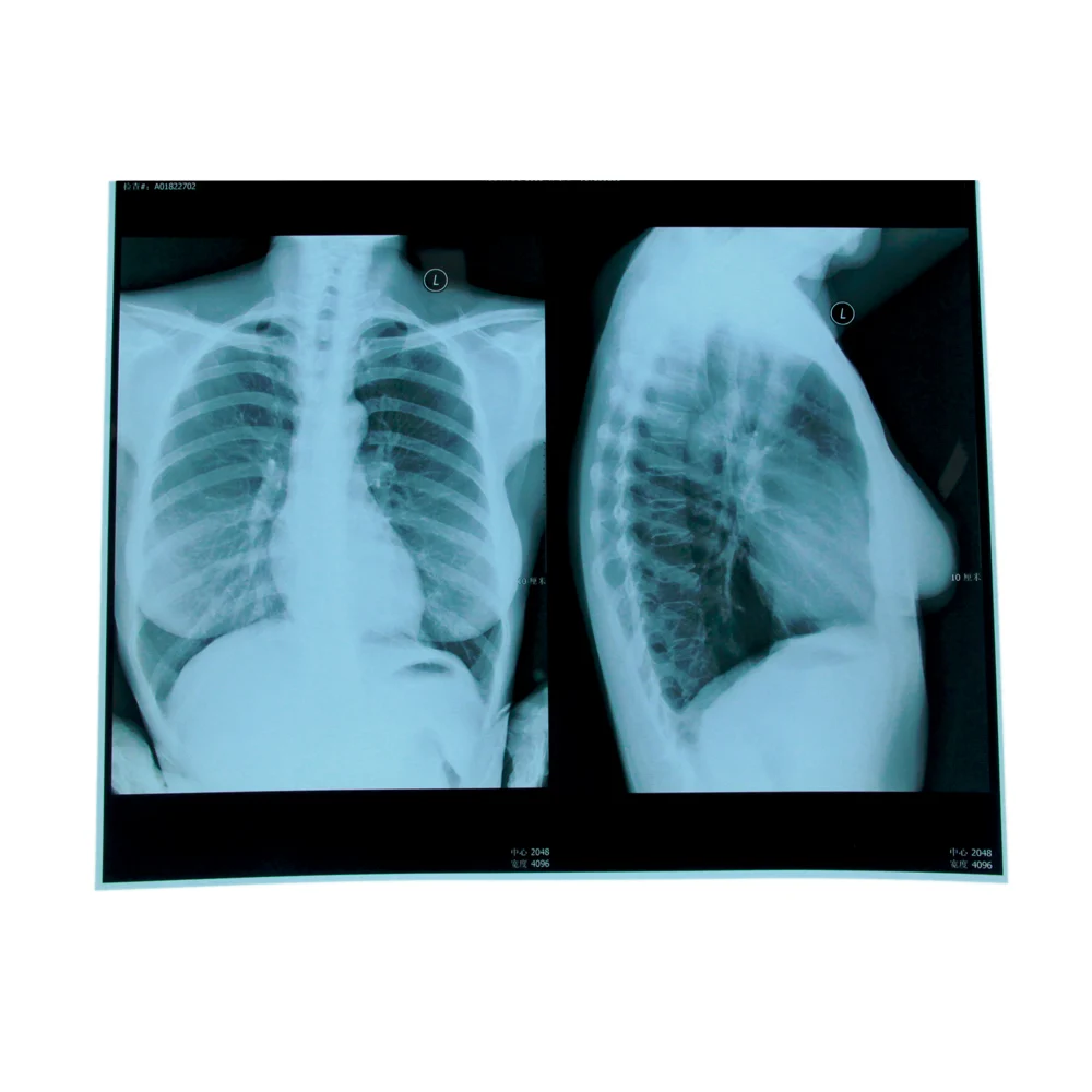 
Kodak laser x-ray film carestream dryview dvb laser imaging film for CT DR CR 
