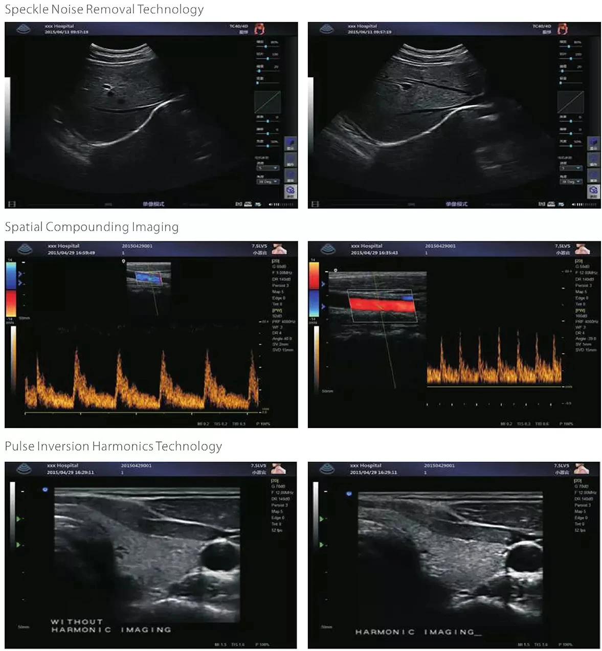 MSLCU46 portable ultrasonic diagnostic devices Cardiac Vascular color doppler echo ultrasound machine