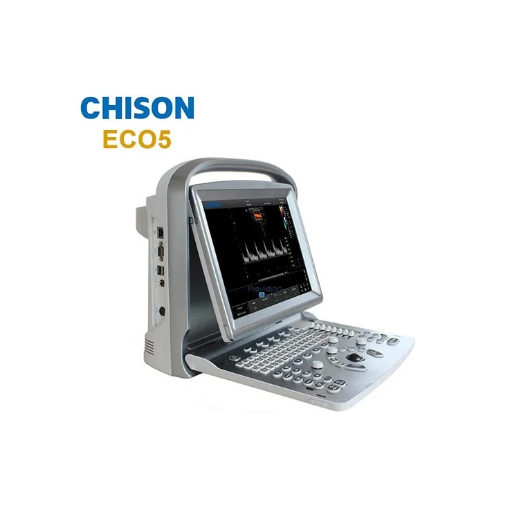 
medical portable color doppler ultrasound Chison eco 5 