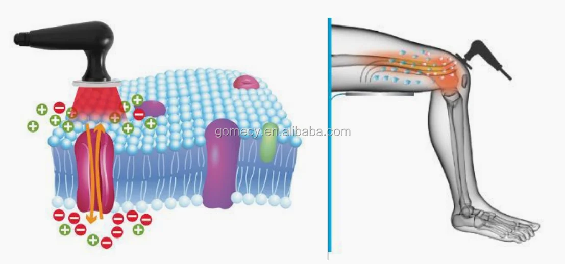 portable-tecar-terapia-physiotherapy-pain-relief-physical-therapy-machine-tecar-terapia-diathermy-shockwave-physiotherapy-device