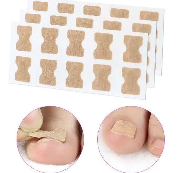 

10pcs Glue Free Ingrown Toenail Correction Tool Pedicure Sticker Inflammatory Toenail Orthotic Patch, Dark skin
