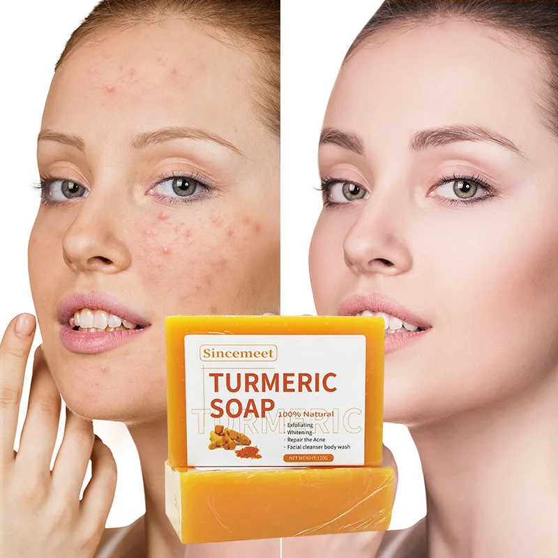 

Best Selling Custom Packaging Logo 100% Natural Face Cleaning Soap Handmade Anti Acne Treatment Whitening 120g Turmeric Soap Bar
