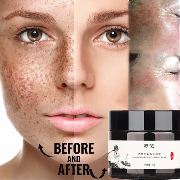 

New Dark Spot Corrector Remover Facial Whitening CreamSkin Brightening Cream Freckle Remover Cream for Melasma Treatment Lighten