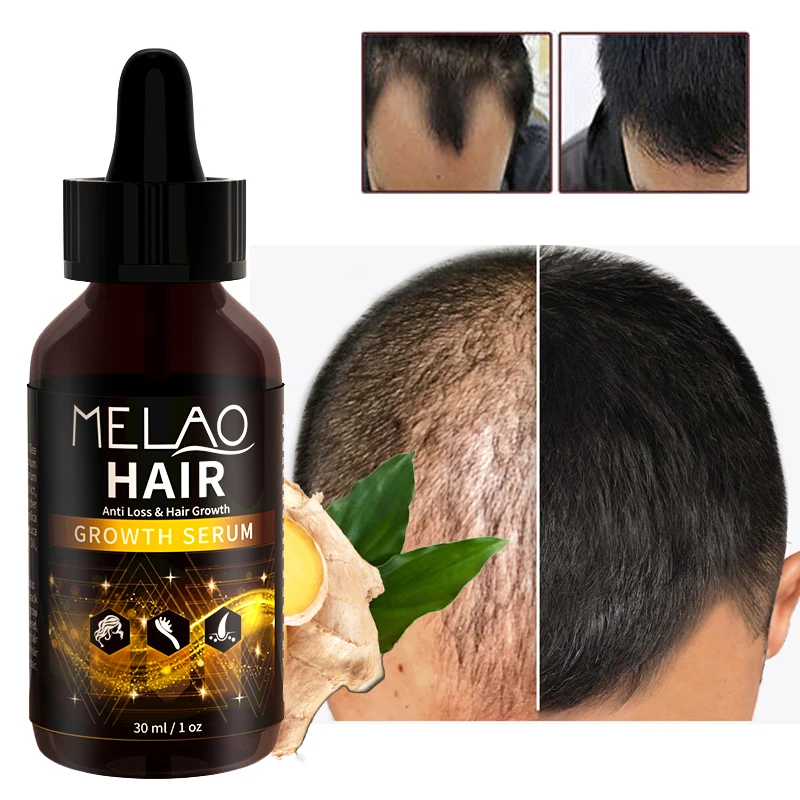 

MELAO Private Label Reduces Dandruff Hair Repairment Moisturizing Hairline Growth Oil Drops Biotin For Men And Women