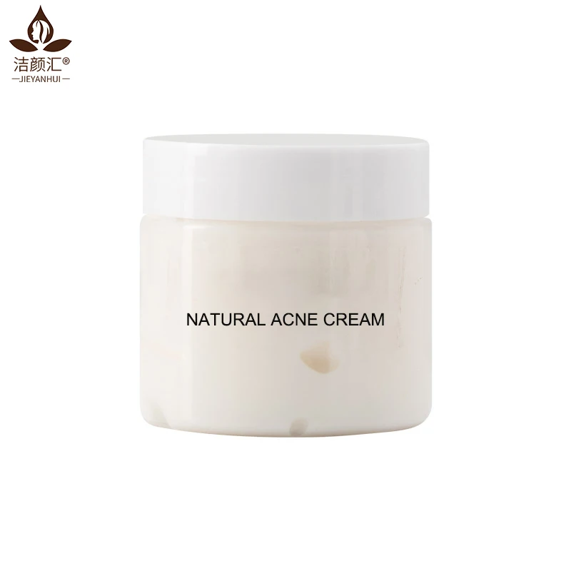 Wholesales private label acne pimple remove cream Beauty Pure Skin Care acne scar removal cream