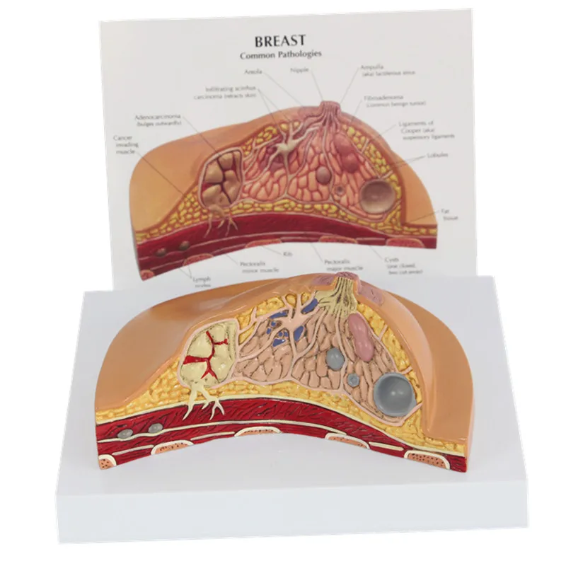 Pathological anatomy. Макет груди. Китайская анатомия.