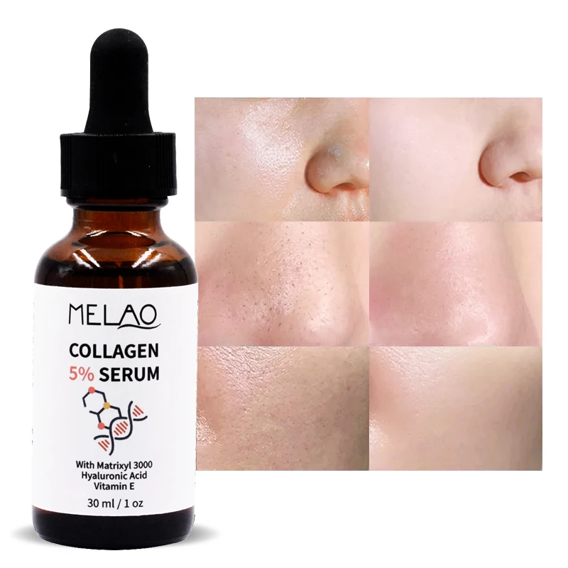 

MELAO Private Label Skin Care Facial Serum Moisturizing Face Whitening Nourishing Repairing TCA Acid Peel Collagen Serum