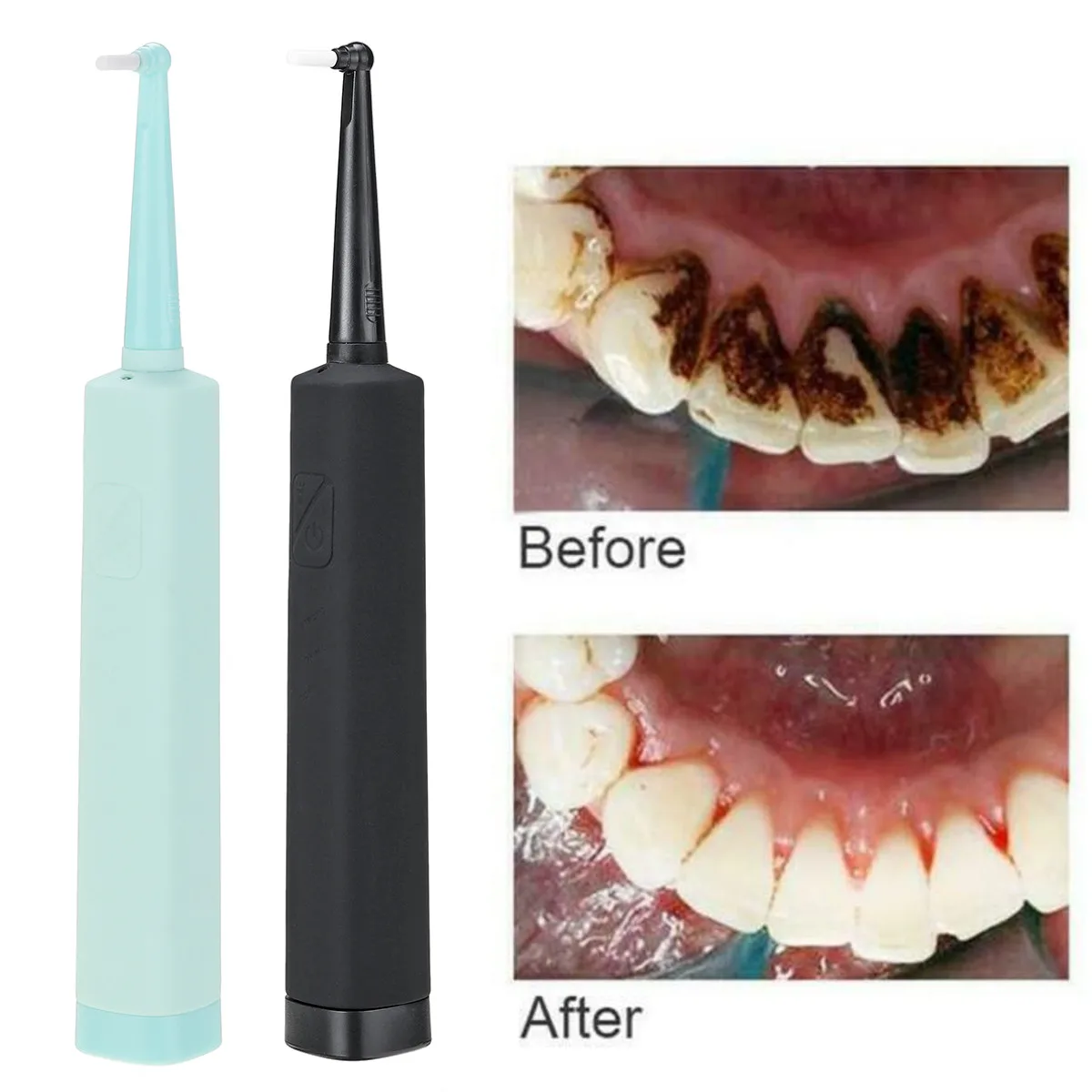 

Rechargeable Ultrasonic Dental Scaler Tooth Calculus Remover Tooth Stains Tartar Cleaner Tool Teeth Whitening Teeth