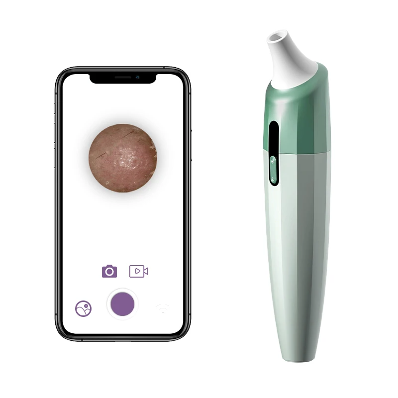 

Visual Facial Pore Vacuum Blackhead Remover with Camera, Green, pink