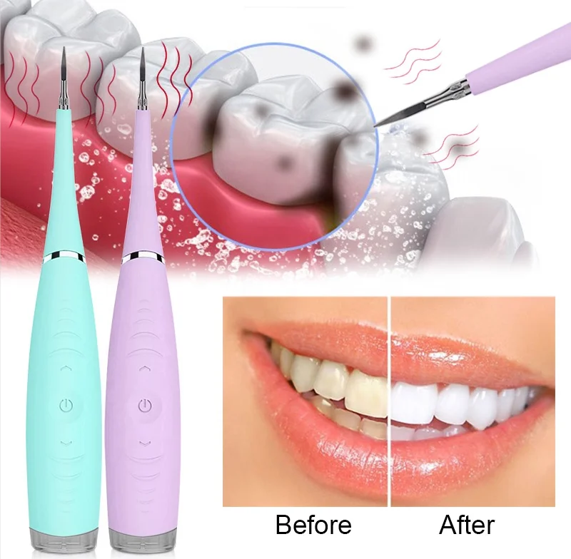 

Best Oral Teeth Whitening Tool Water Cleaning Dental Scaler Portable Calculus Remover Machine Electric Ultrasonic Tooth Cleaner, Blue/pink/black