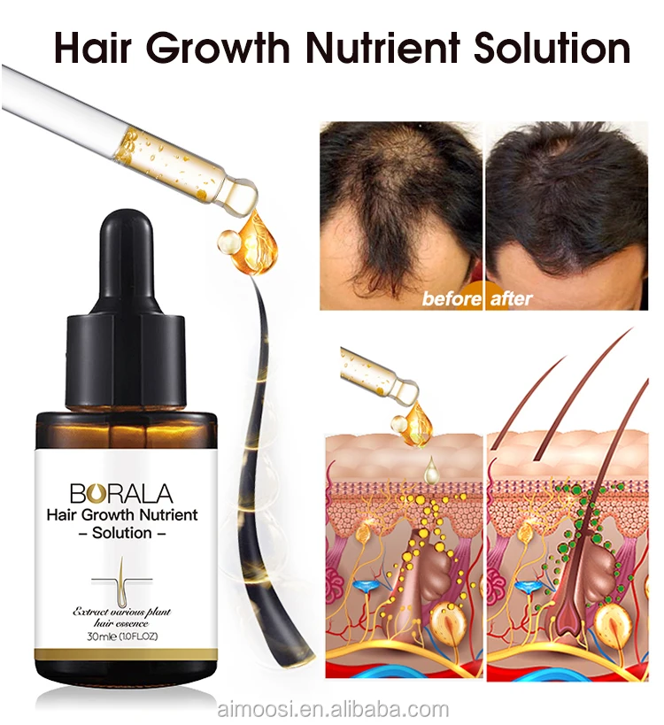 World Best Herbal Hair Regrowth Product Fast Hair Growth Essence Serum ...